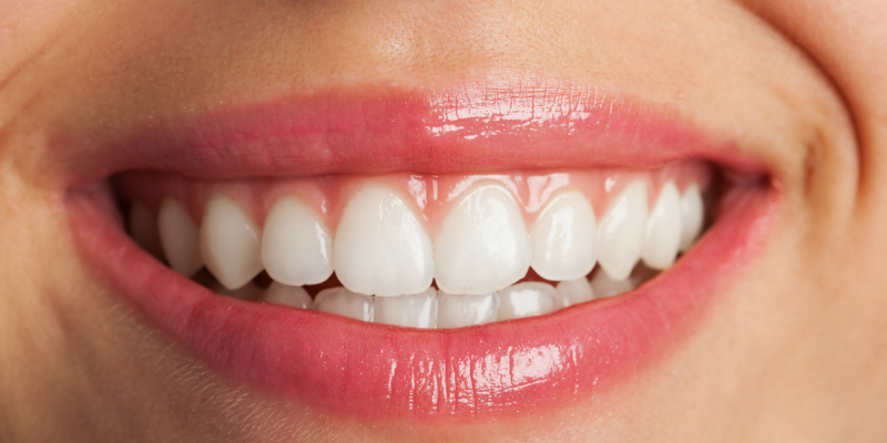 Saúde bucal: Entenda por que você precisa de um plano odontológico